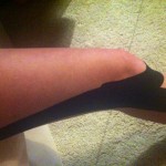 The wonders of physio